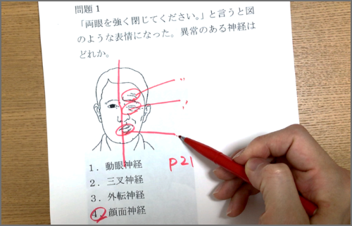 国家試験の問題を解説